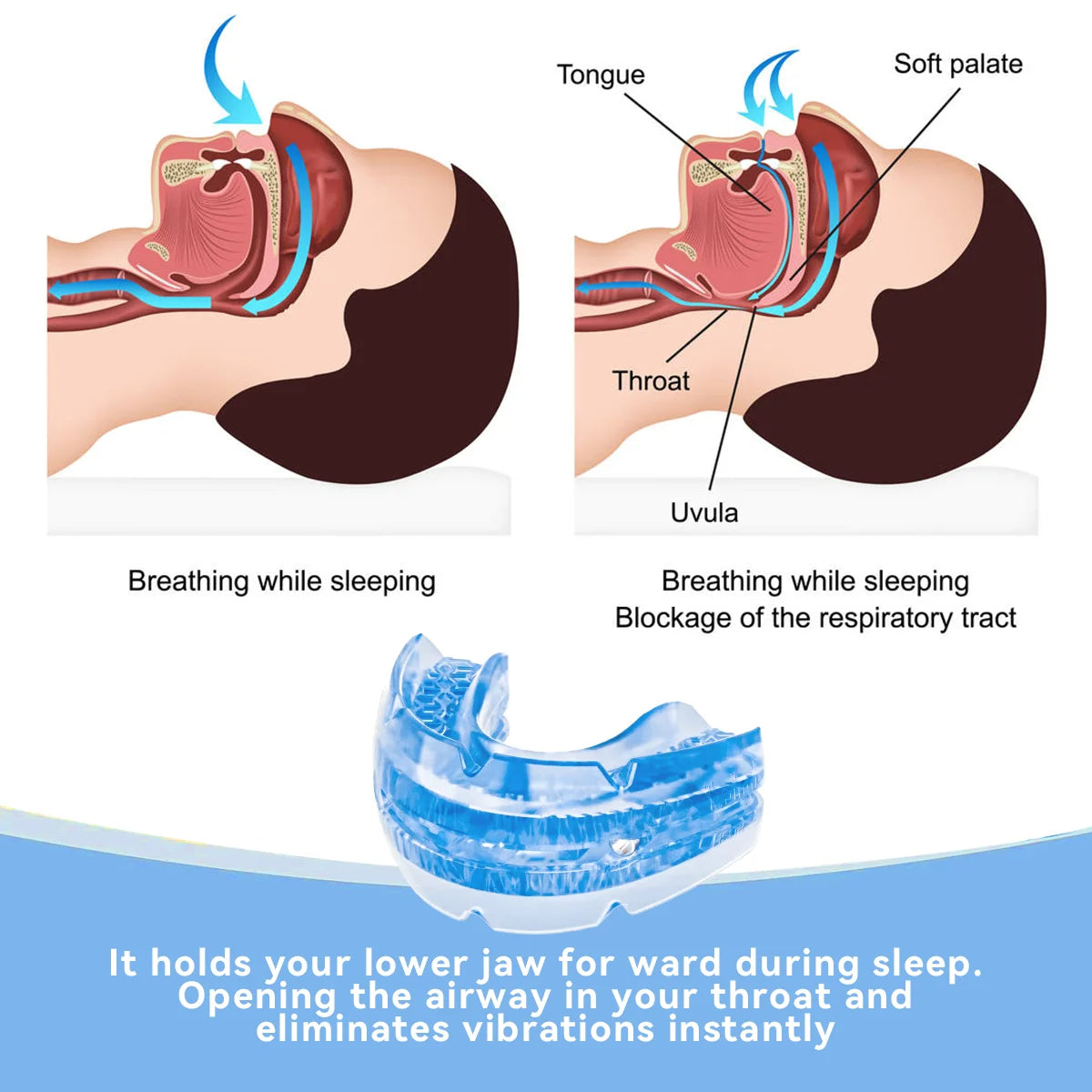 Embout buccal anti-ronflement réglable 2
