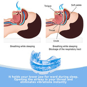 Embout buccal anti-ronflement réglable 2