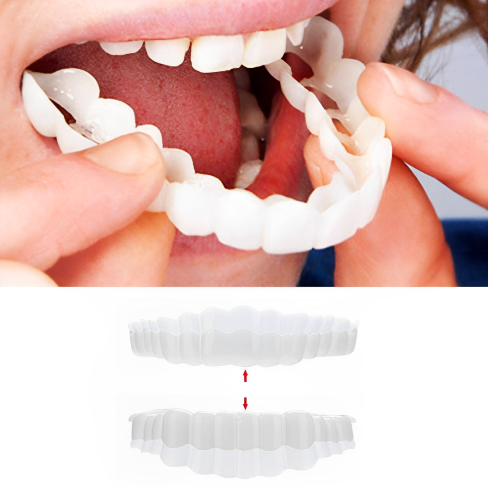 Smile Plavier (Upper & inférieur inclus) 0