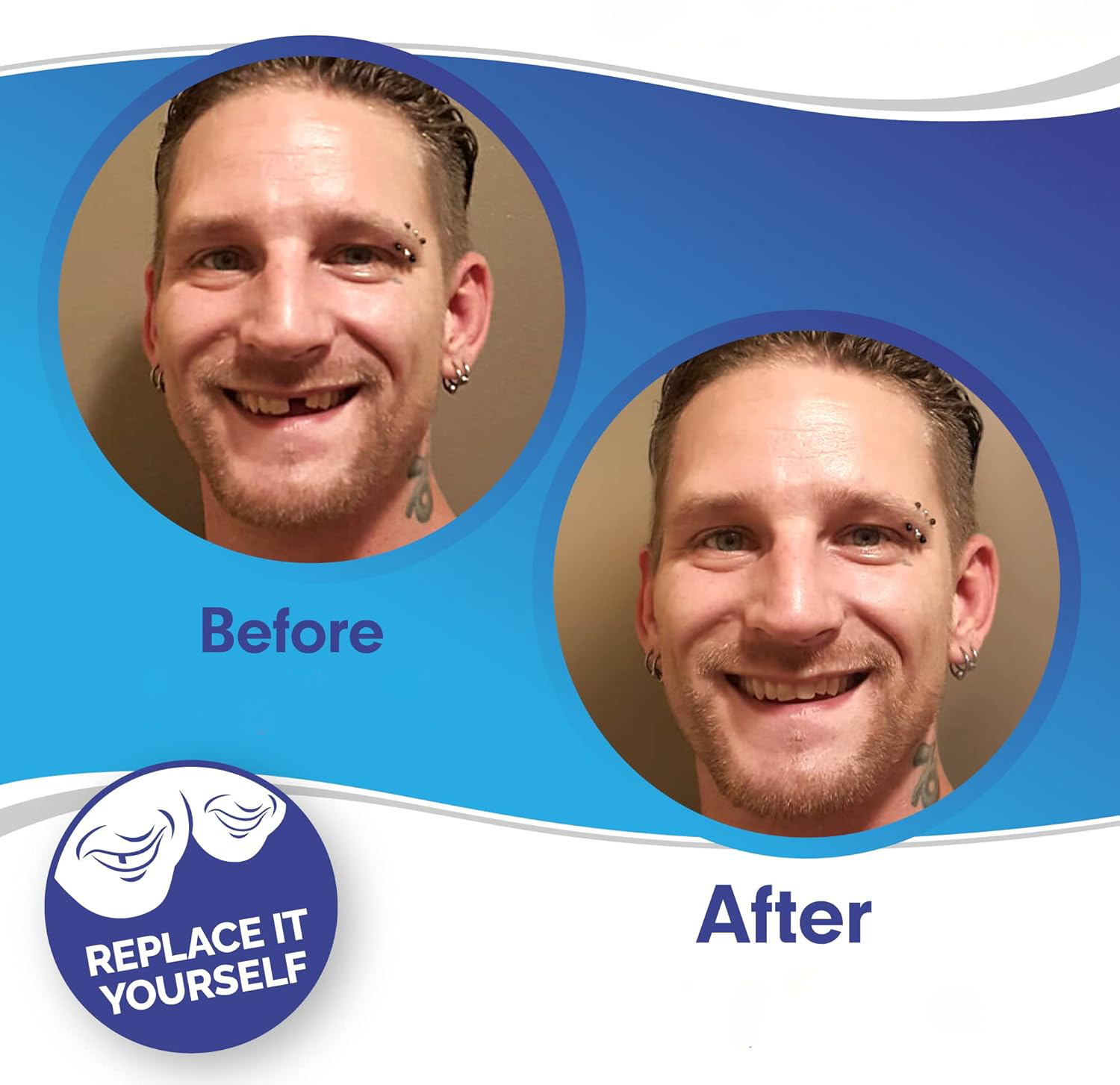 Smile Plavier (Upper & inférieur inclus) 1