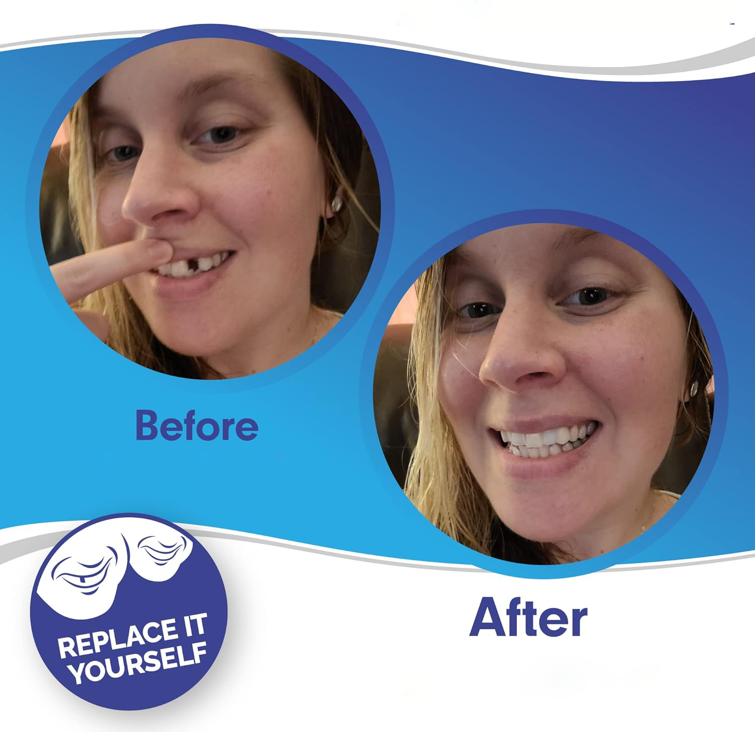 Smile Plavier (Upper & inférieur inclus) 2