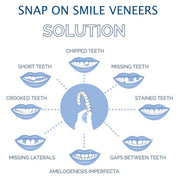 Smile Plavier (Upper & inférieur inclus) 5
