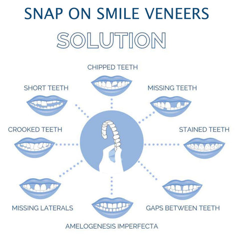 Smile Plavier (Upper & inférieur inclus) 5