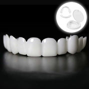Transformation instantanée du sourire avec les facettes Snap on Smile 0