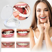 Transformation instantanée du sourire avec les facettes Snap on Smile 1