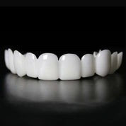 Transformation instantanée du sourire avec les facettes Snap on Smile 2